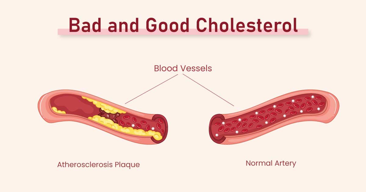 Benefits of Arjun Chaal - Subhash Goyal Blog