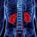 Kidney Damage Symptoms