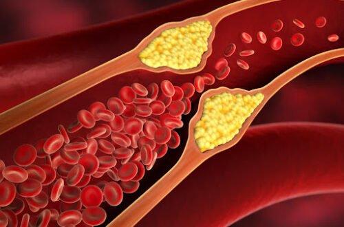 Signs of High Cholesterol in Fingers at Night