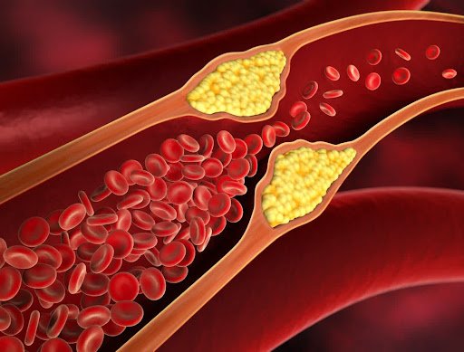 Signs of High Cholesterol in Fingers at Night