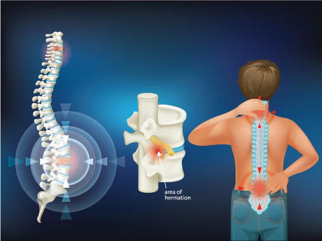 Paralysis Causes